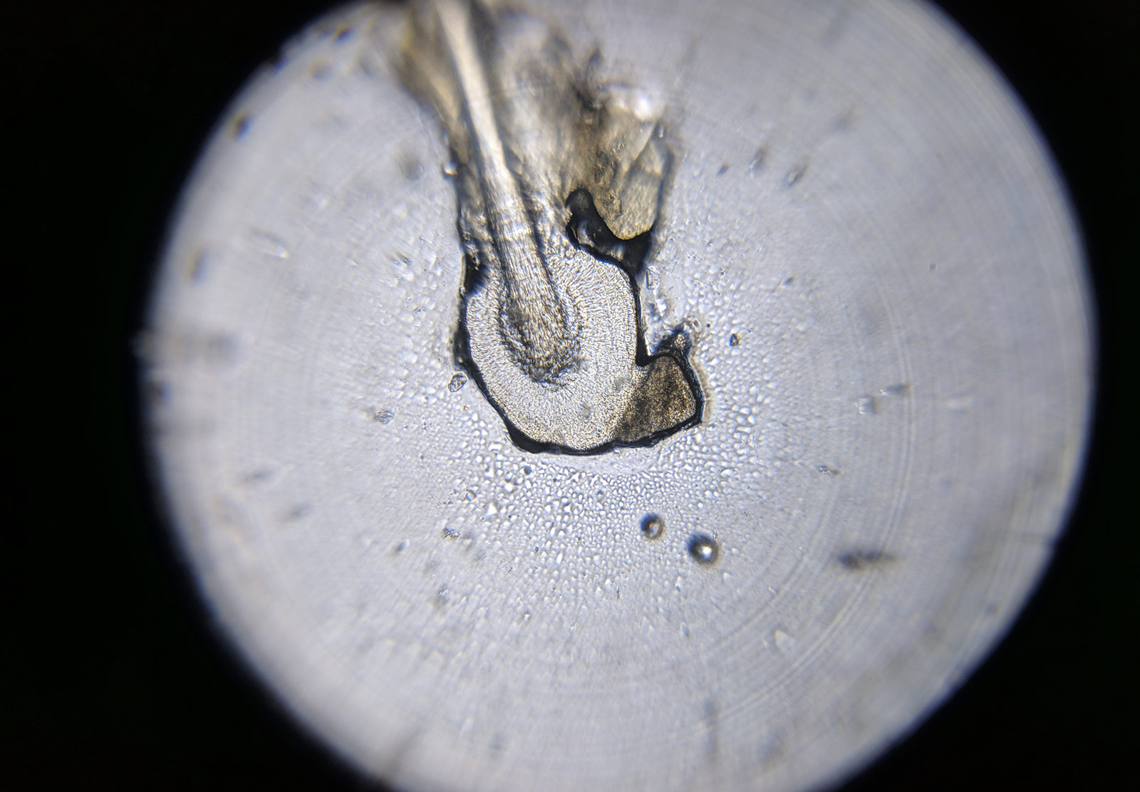 Hair folicle under microscope